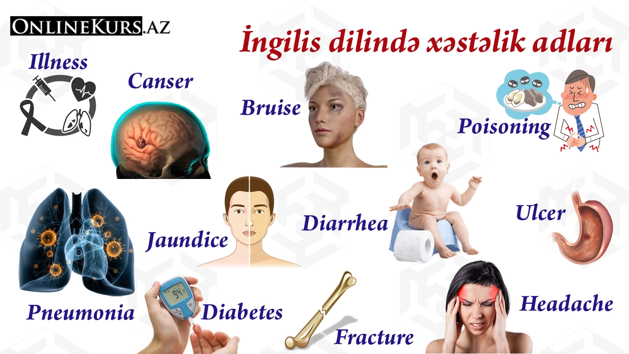 İngilis dilində xəstəlik adları